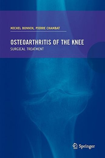 osteoarthrisis of the knee