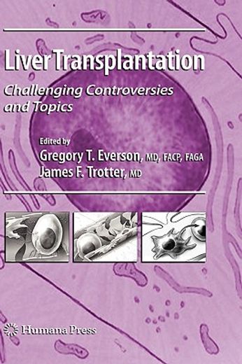 liver transplantation,challenging controversies and topics