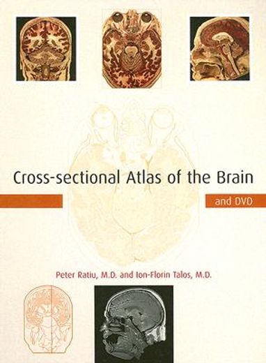 cross-sectional atlas of the brain
