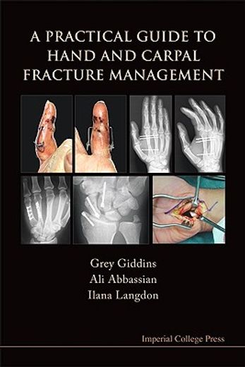A Practical Guide to Hand and Carpal Fracture Management (en Inglés)