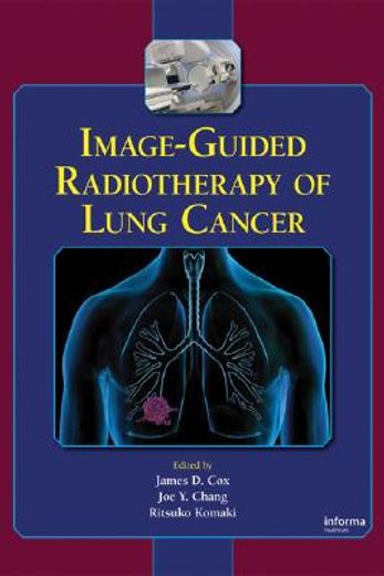 image-guided radiotherapy of lung cancer