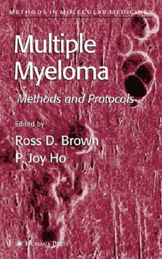 Multiple Myeloma: Methods and Protocols (in English)