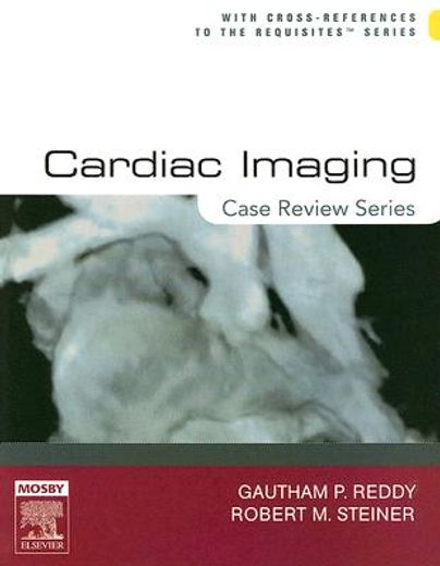 cardiac imaging