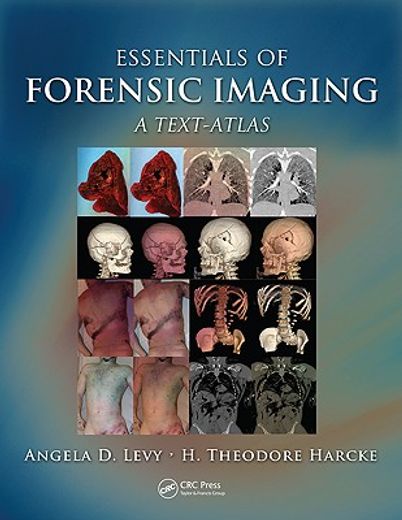 Essentials of Forensic Imaging: A Text-Atlas (en Inglés)