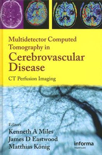 Multidetector Computed Tomography in Cerebrovascular Disease: CT Perfusion Imaging (en Inglés)
