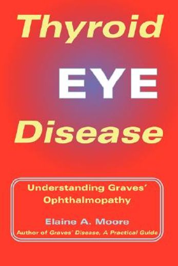 thyroid eye disease,understanding graves ophthalmopathy (en Inglés)
