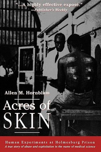 acres of skin,human experiments at holmesburg prison : a true story of abuse and exploitation in the name of medic
