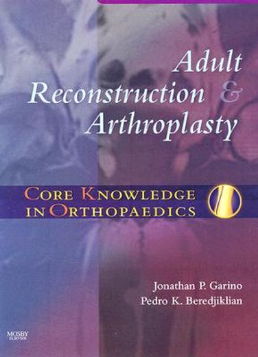 adult reconstruction & arthroplasty