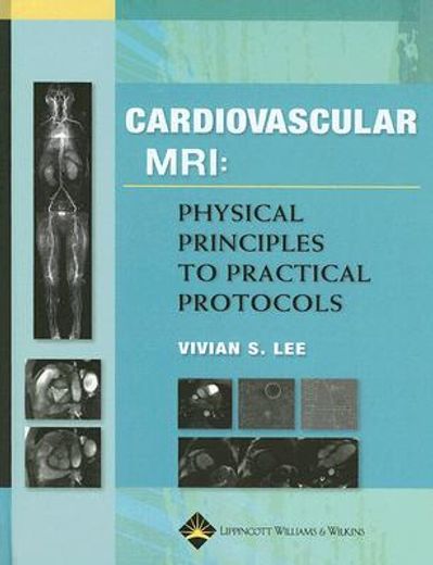 cardiovascular mri,physical principles to practical protocols