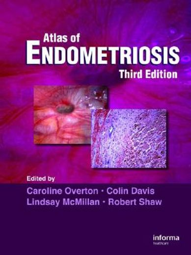 an atlas of endometriosis