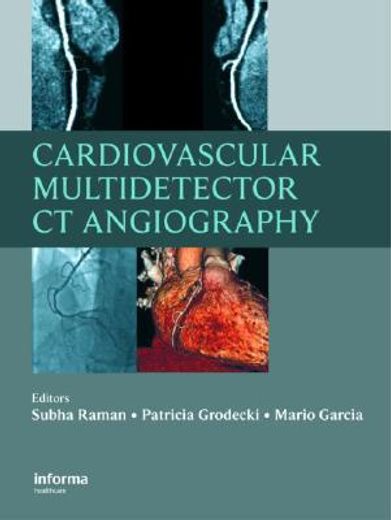 Cardiovascular Multidetector CT Angiography (en Inglés)