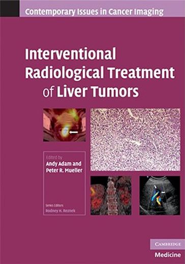 interventional radiological treatment of liver tumors