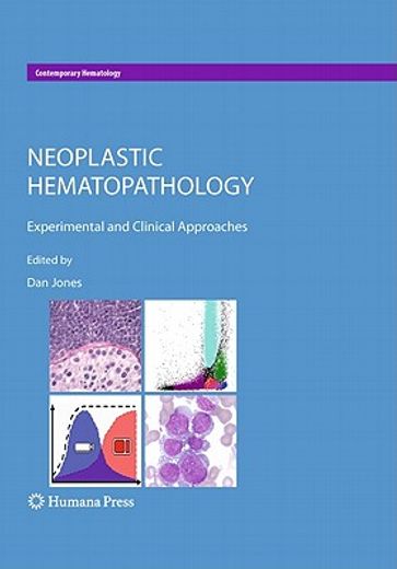 Neoplastic Hematopathology: Experimental and Clinical Approaches (in English)