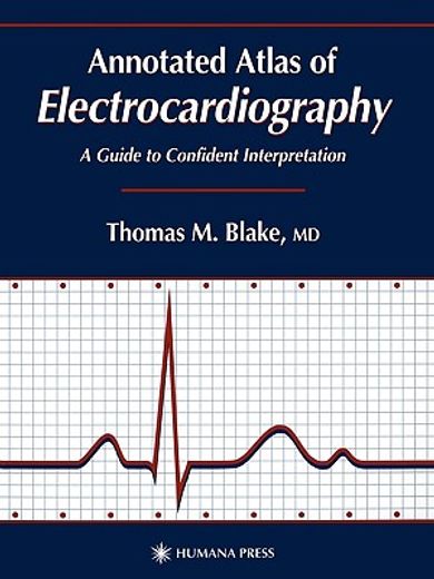 annotated atlas of electrocardiography,a guide to confident interpretation