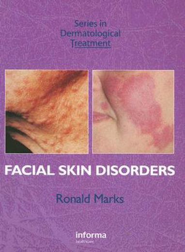 Facial Skin Disorders (en Inglés)