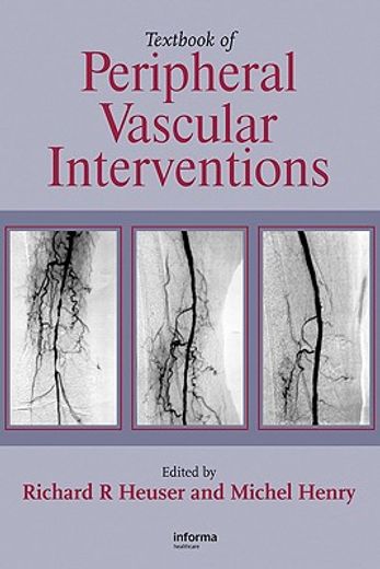 Textbook of Peripheral Vascular Interventions (en Inglés)