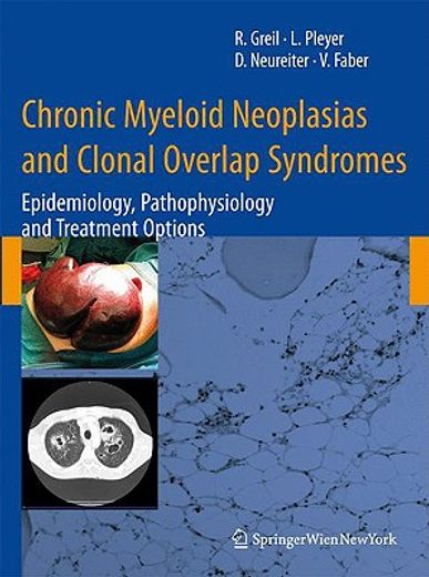 Chronic Myeloid Neoplasias and Clonal Overlap Syndromes: Epidemiology, Pathophysiology and Treatment Options (en Inglés)