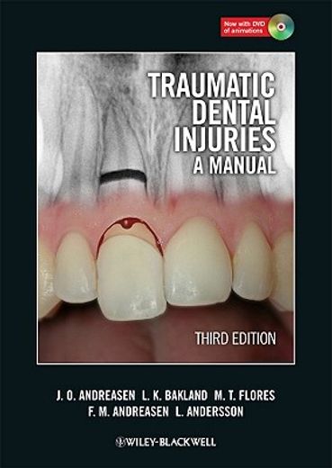 Traumatic Dental Injuries: A Manual [With DVD ROM] (en Inglés)