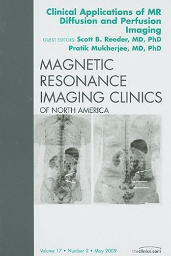 Clinical Applications of MR Diffusion and Perfusion Imaging, an Issue of Magnetic Resonance Imaging Clinics: Volume 17-2 (en Inglés)