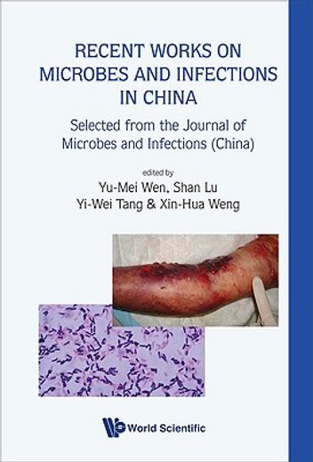 recent works on microbes and infections in china,selected from the journal of microbes and infections (china)
