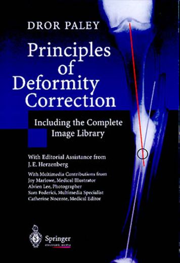 Libro principles of deformity correction,including the complete