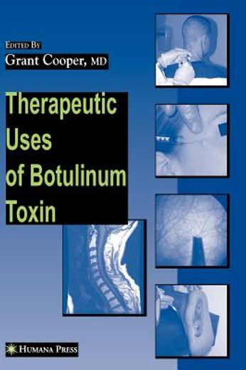 therapeutic uses of botulinum toxin