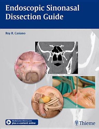 endoscopic sinonasal dissection guide