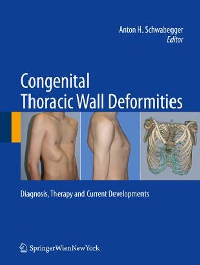 congenital thoracic wall deformities,therapy and future developments