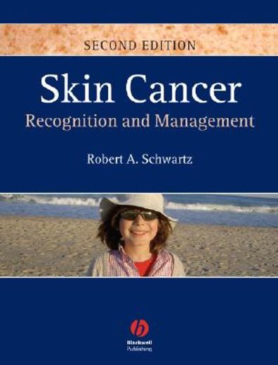 skin cancer,recognition and management
