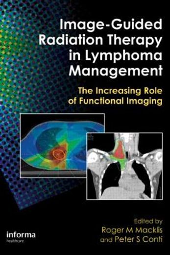 Image-Guided Radiation Therapy in Lymphoma Management: The Increasing Role of Functional Imaging (en Inglés)